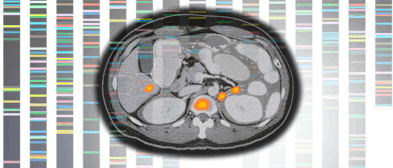 brain MRI image